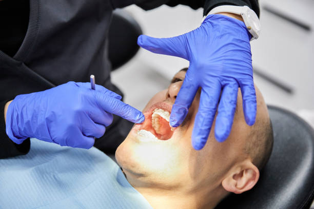 Best Chipped Tooth Repair Near Me  in Fultonde, AL